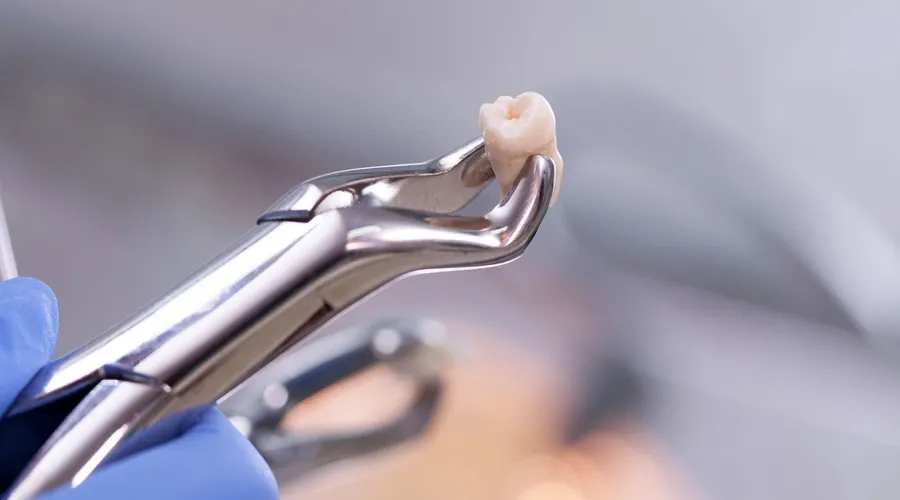 CEREC Same-Day Crowns at CrossPointe Dental